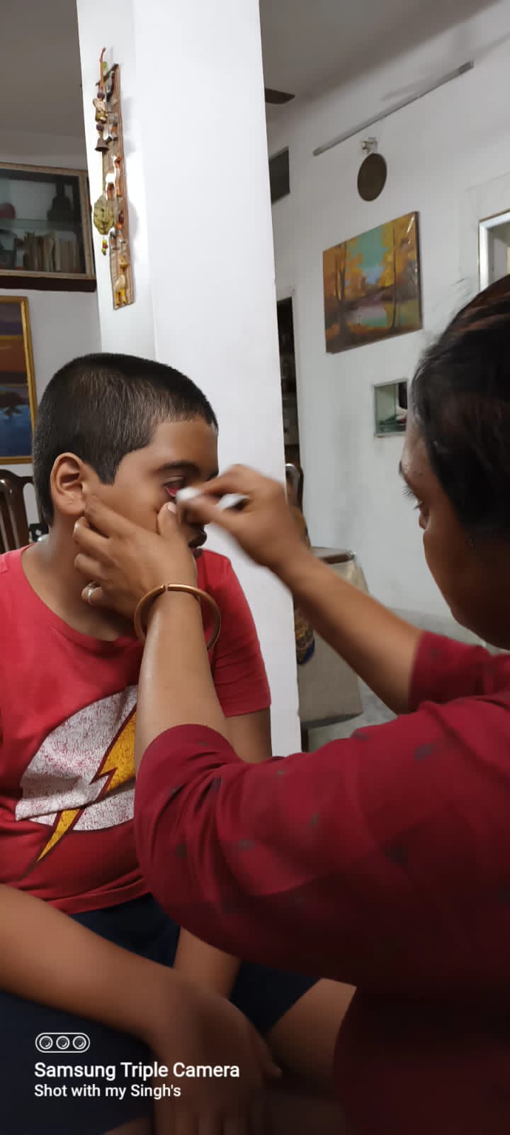 Eye care in India